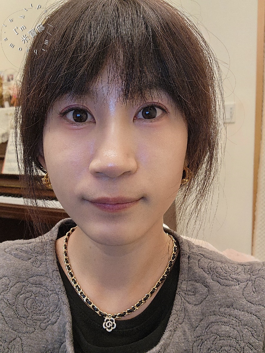 佳飛雅緻美學┃台北中山。海芙電波讓整個臉部輪廓更顯少女感，維持青春的小秘密