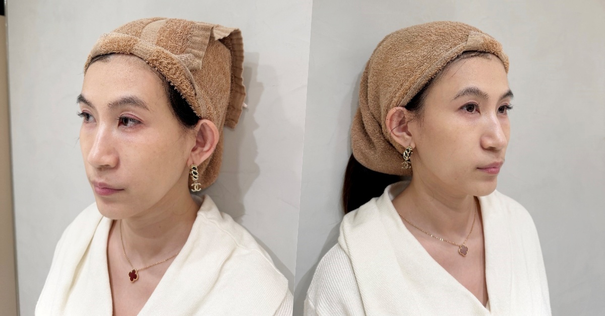 葛鎂診所｜台北中正區醫美推薦！平日保養升級，讓保養品超有感，告別卡粉粉刺，素顏淡妝都吸睛！