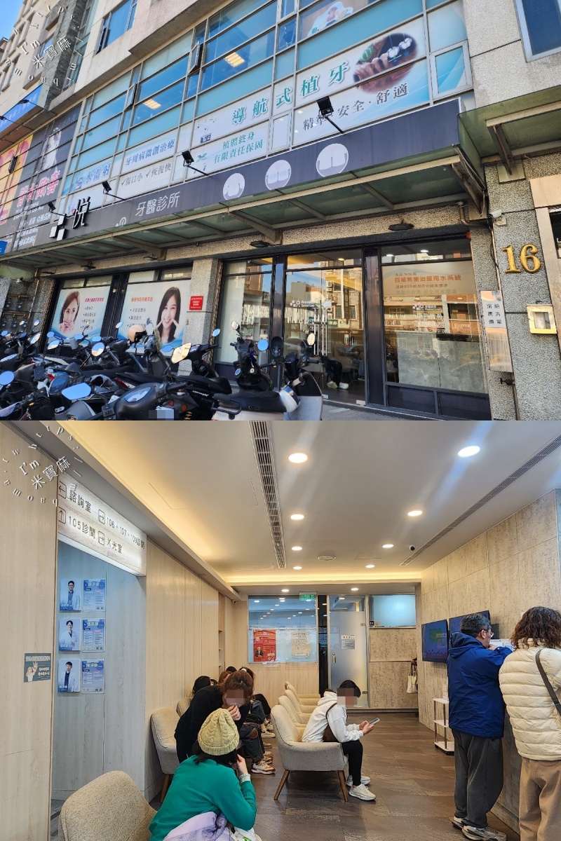 睡一覺牙齒就變白？睡前【 居家美白 】牙齒美白紀錄，牙齒變白過程分享｜竹北品悅牙醫診所｜新竹牙齒美白推薦