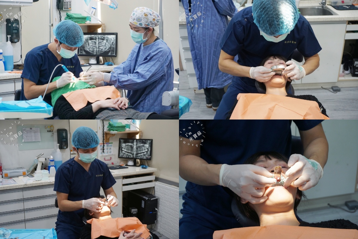 睡一覺牙齒就變白？睡前【 居家美白 】牙齒美白紀錄，牙齒變白過程分享｜竹北品悅牙醫診所｜新竹牙齒美白推薦