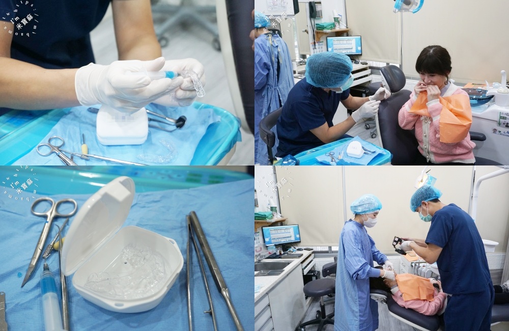 睡一覺牙齒就變白？睡前【 居家美白 】牙齒美白紀錄，牙齒變白過程分享｜竹北品悅牙醫診所｜新竹牙齒美白推薦