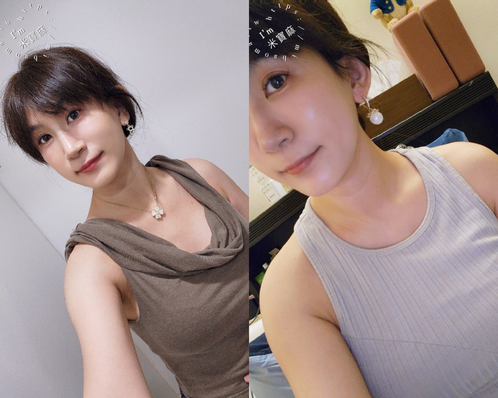 名悅時尚診所｜肉毒小臉讓你告別修修臉，夏天薄透妝感也能自信出門！