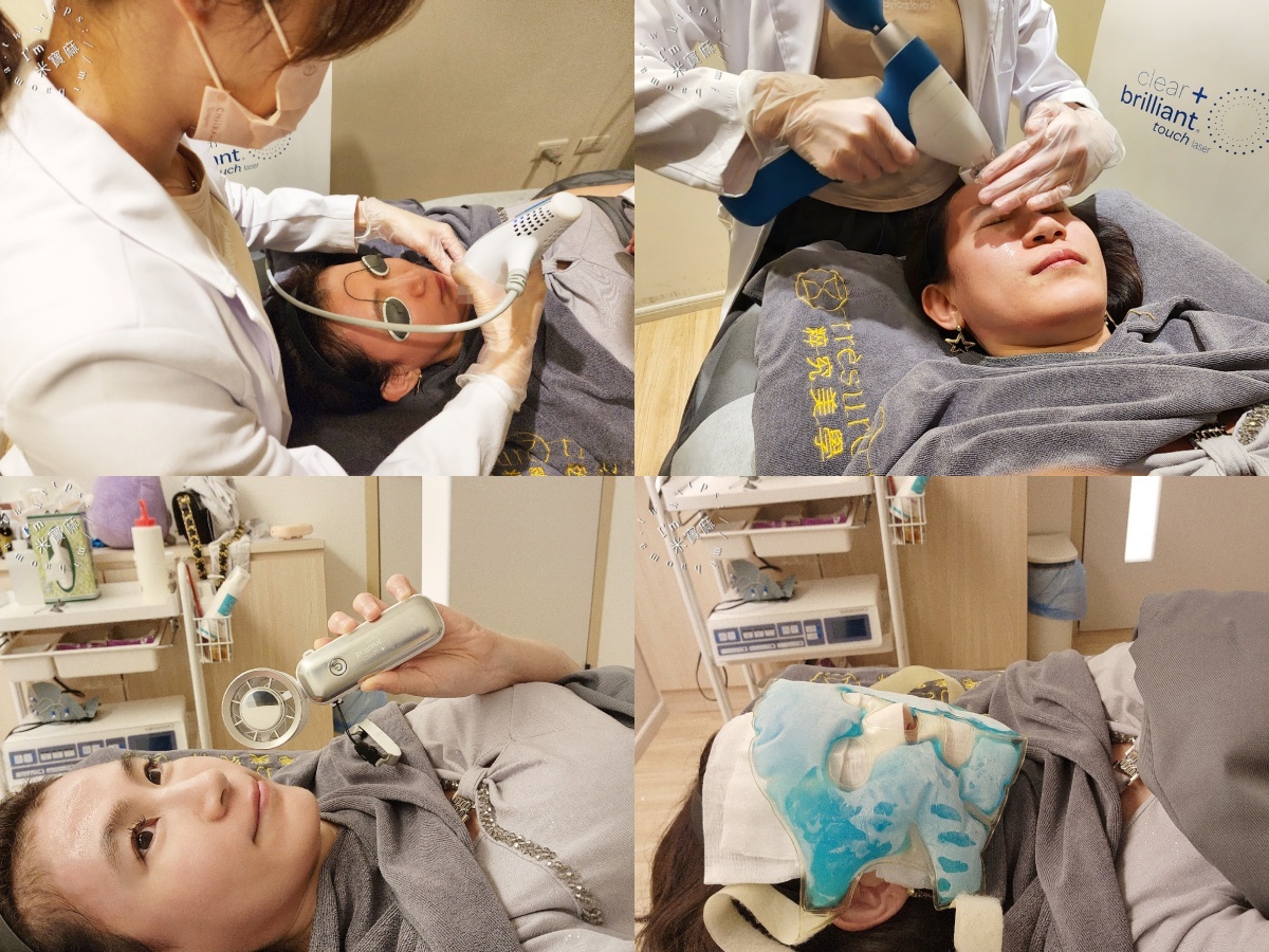 粹究美學鳳凰光：無痛動態養膚體驗，中山區醫美推薦的真實心得