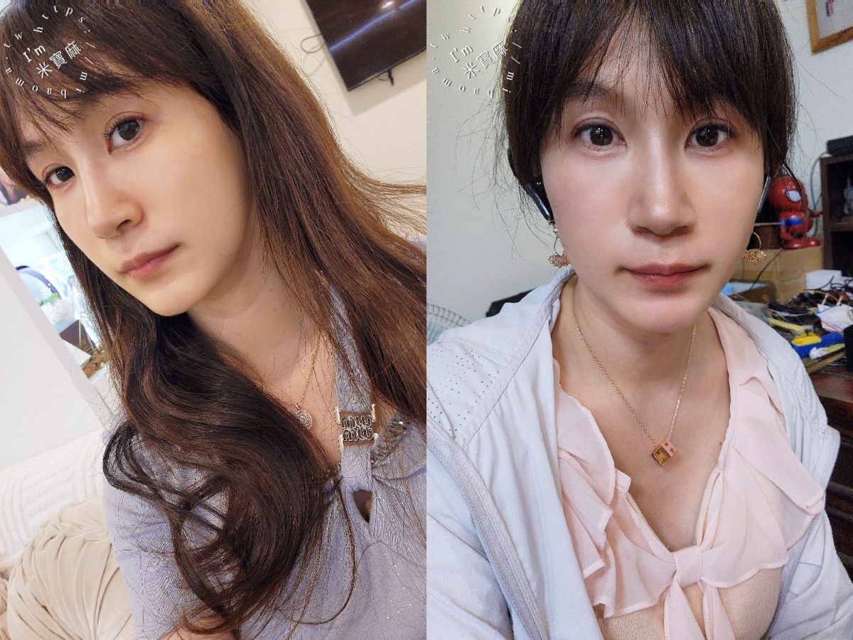 粹究美學鳳凰光：無痛動態養膚體驗，中山區醫美推薦的真實心得