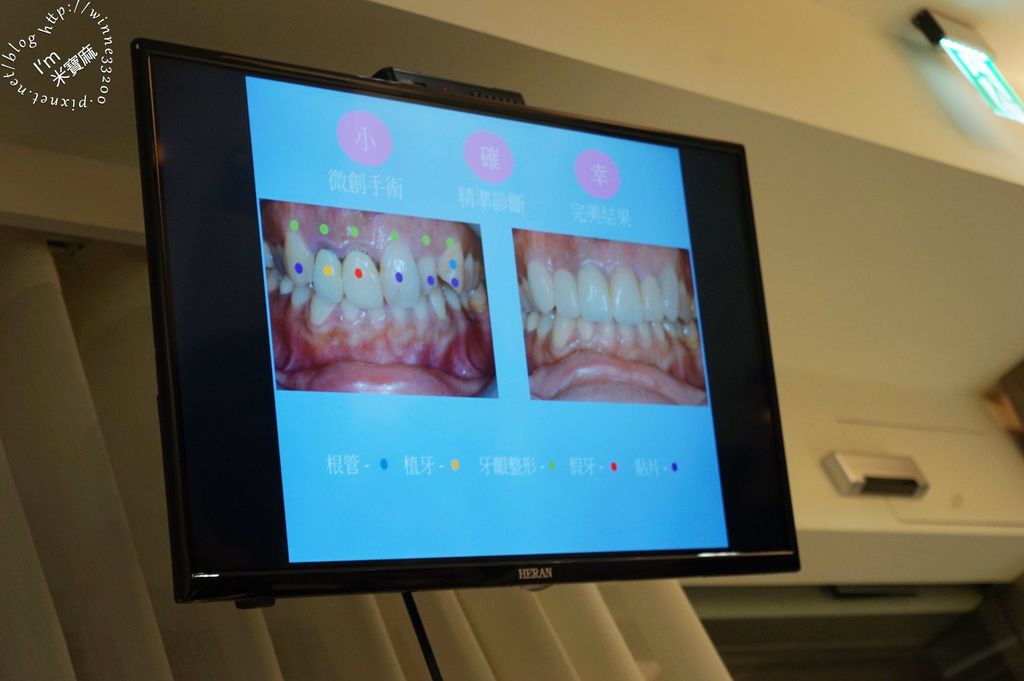 永和博誠牙醫診所 植牙39